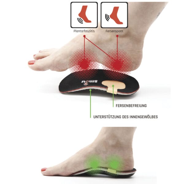 SMOU HEEL Heel Pads für Fersensporn und Plantarfasziitis | Professionelle orthopädische Fußeinlegesohlen für Frauen oder Männer | Behandelt Schmerzen bei Platt- oder Hohlfüßen.
Von Orthopäden patentiert – Bild 3