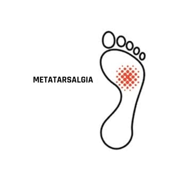 Plantilla para alivio de la metatarsalgia