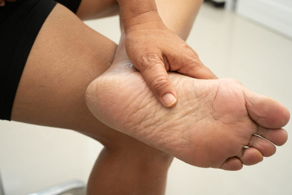 exercises for plantar fasciitis