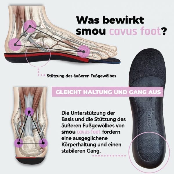 SMOU Cavus Foot · Einlegesohlen für Hohlfüße - 4