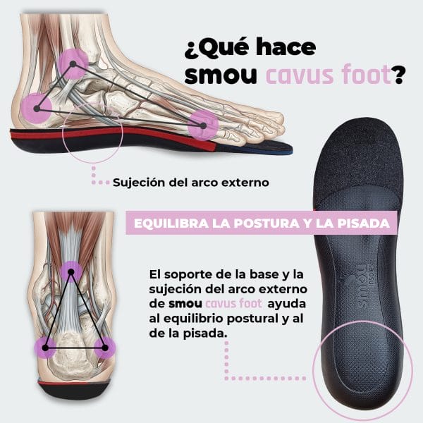 SMOU Cavus Foot · Palmilhas para pé cavo - Image 4