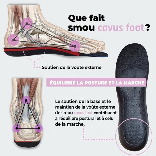 SMOU Cavus Foot · Semelles pour pieds creux - 4