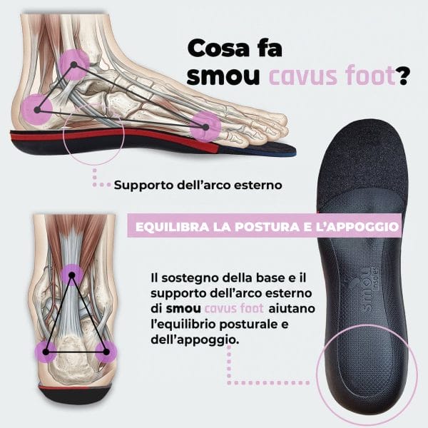 SMOU Cavus Foot · Solette per piede cavo - 4