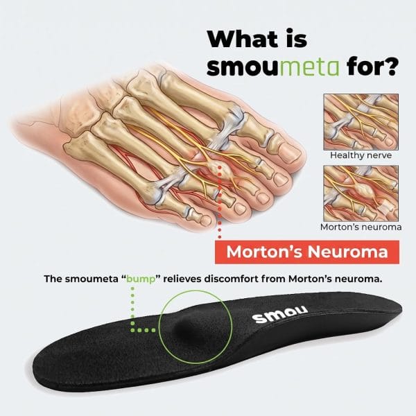 SMOU Meta · Insoles with metatarsal bar for metatarsalgia - 6