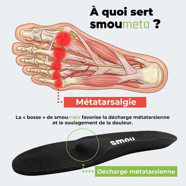 SMOU Meta · Semelles avec barre métatarsienne pour la métatarsalgie - 5