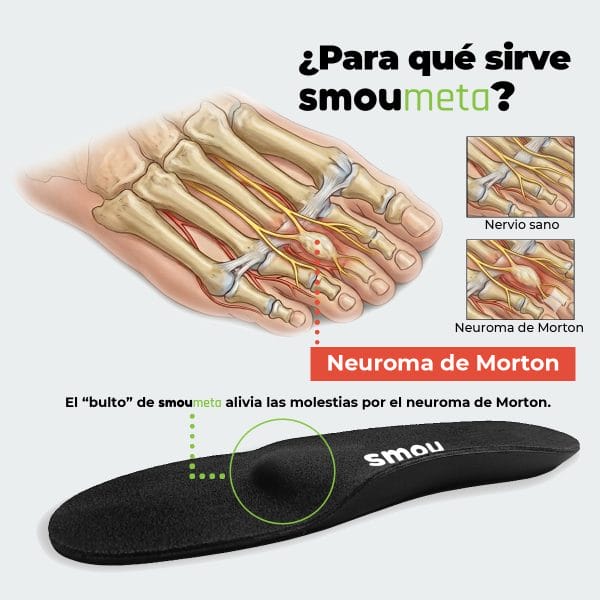 SMOU Meta · Palmilhas com barra metatarsal para metatarsalgia - Image 6
