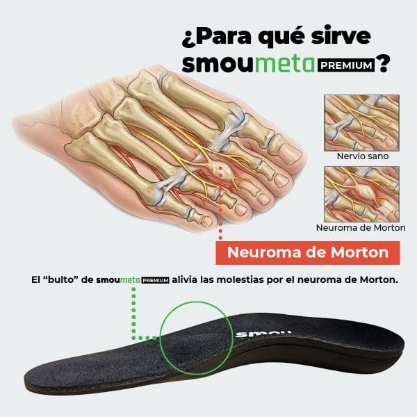 SMOU Meta Premium · Semelles pour métatarsalgie avec soutien de la voûte plantaire - 6